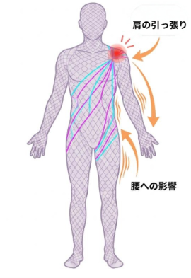 全身の筋膜(ファシア)はつながっていて、肩の引っ張りが腰まで影響する図解